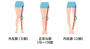 O脚は治ります ポジティブストレッチ 栄 名古屋駅 今池 四日市のストレッチ専門店